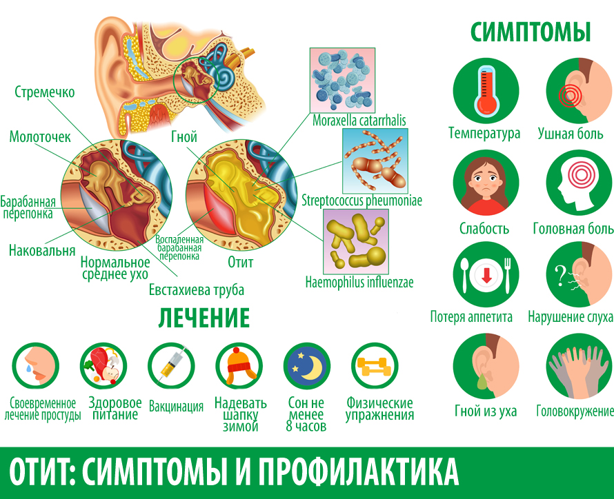 Отит у детей: симптомы